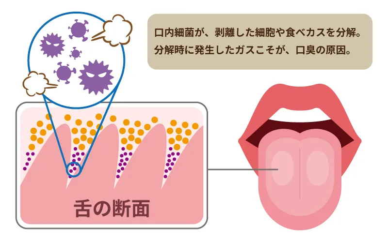 口臭発生のメカニズム